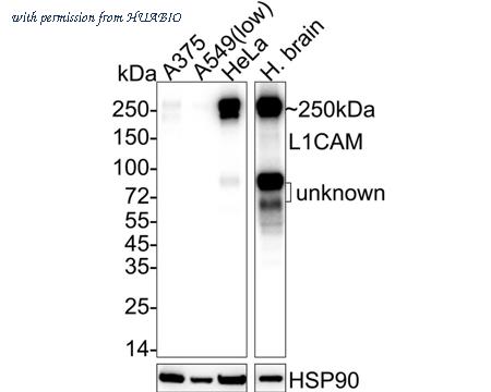 HUABIO ET1703-51 image 1