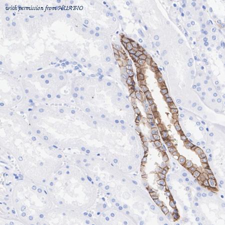 HUABIO ET1703-51 image 2