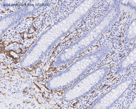 HUABIO ET1703-51 image 3