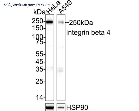 HUABIO ET1703-52 image 1