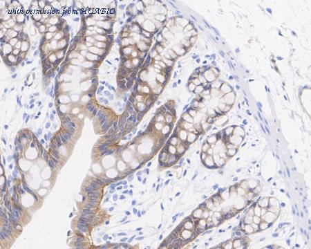 HUABIO ET1703-52 image 2