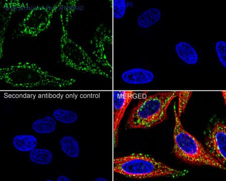 HUABIO ET1703-53 image 2