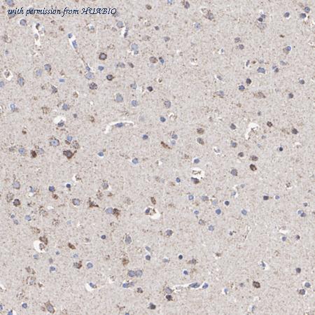 HUABIO ET1703-53 image 3