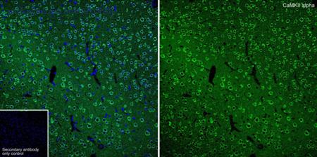 HUABIO ET1703-54 image 2