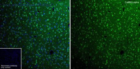 HUABIO ET1703-54 image 3