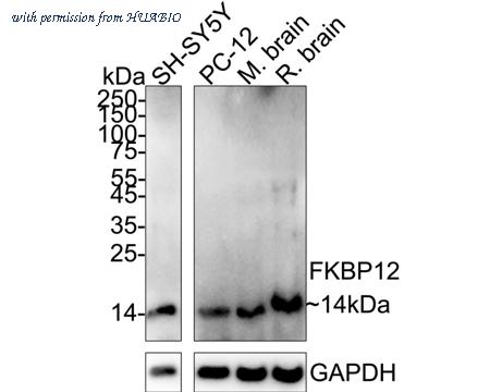 HUABIO ET1703-55 image 1