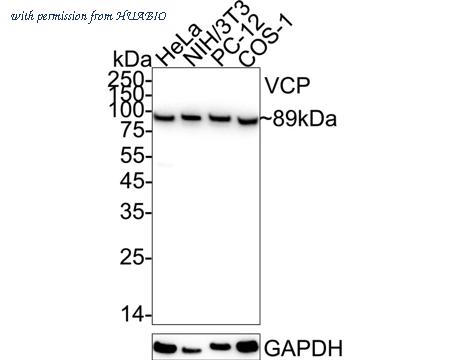 HUABIO ET1703-56 image 1