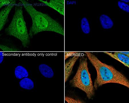 HUABIO ET1703-56 image 2