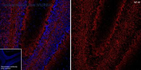 HUABIO ET1703-57 image 1