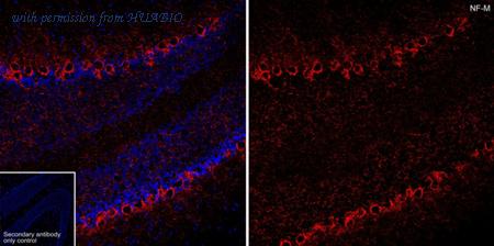 HUABIO ET1703-57 image 2