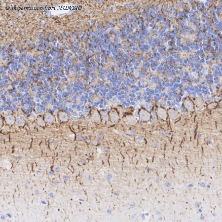 HUABIO ET1703-57 image 3