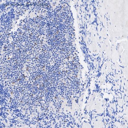 HUABIO ET1703-59 image 2