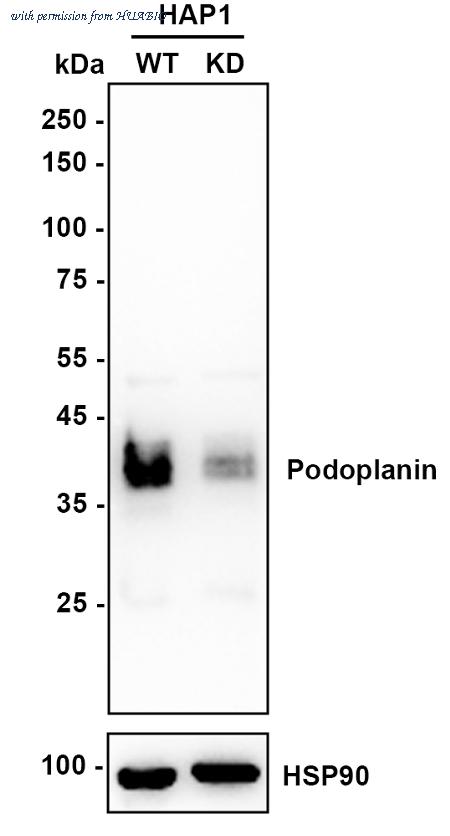 HUABIO ET1703-61 image 1