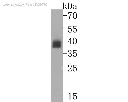 HUABIO ET1703-61 image 2