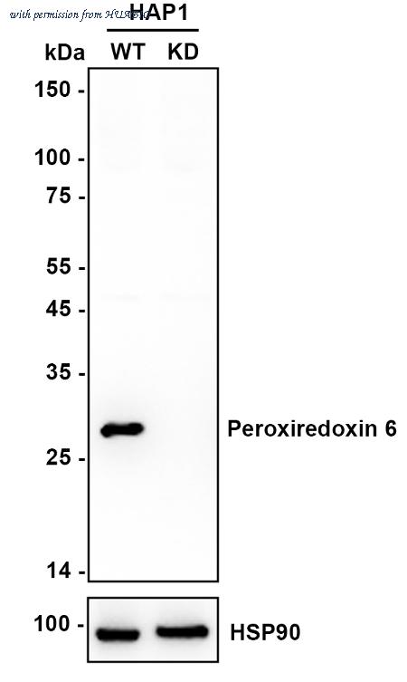 HUABIO ET1703-62 image 2