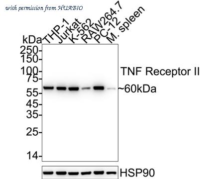 HUABIO ET1703-63-50UL image 1