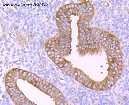 HUABIO ET1703-63-50UL image 2