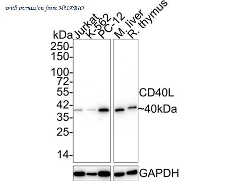 HUABIO ET1703-64 image 1