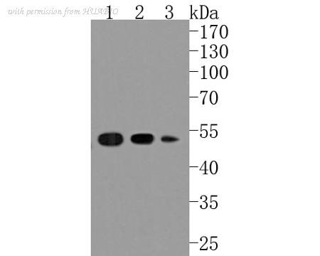HUABIO ET1703-66 image 1