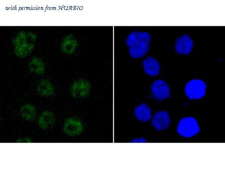 HUABIO ET1703-66 image 2