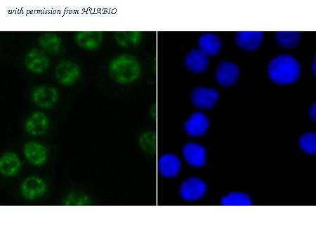 HUABIO ET1703-66 image 3