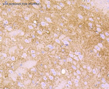 HUABIO ET1703-67 image 2