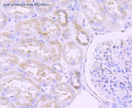 HUABIO ET1703-68 image 3