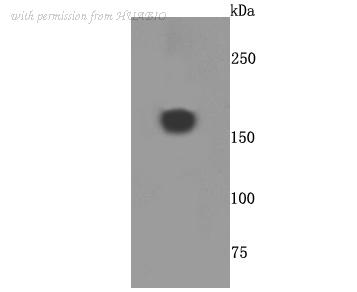 HUABIO ET1703-69 image 1