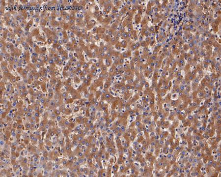 HUABIO ET1703-69 image 3