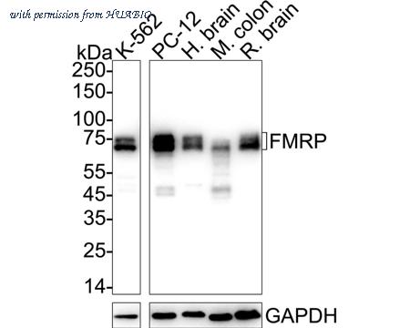 HUABIO ET1703-70 image 1
