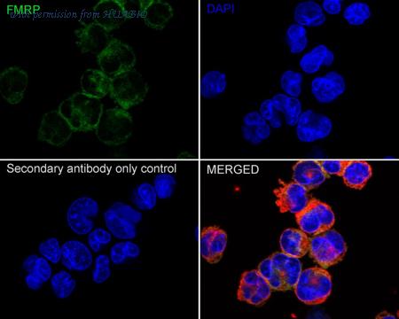 HUABIO ET1703-70 image 2