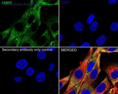 HUABIO ET1703-70 image 3