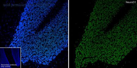 HUABIO ET1703-73 image 1