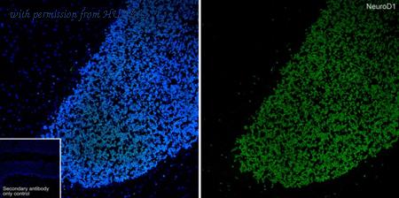HUABIO ET1703-73 image 2