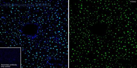 HUABIO ET1703-76 image 1