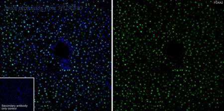 HUABIO ET1703-76 image 2