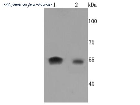 HUABIO ET1703-77 image 1