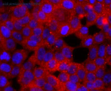 HUABIO ET1703-80 image 2