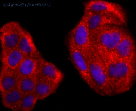 HUABIO ET1703-80 image 3