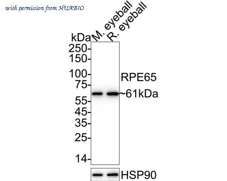 HUABIO ET1703-82 image 1