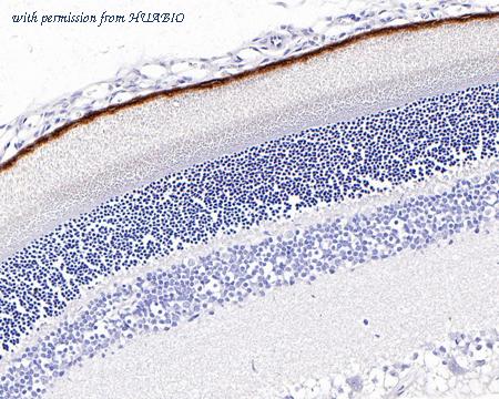 HUABIO ET1703-82 image 2