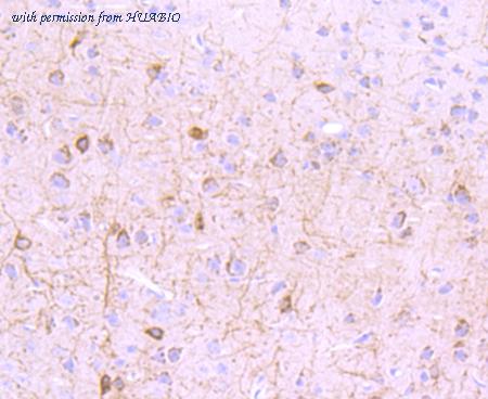 HUABIO ET1703-84 image 2