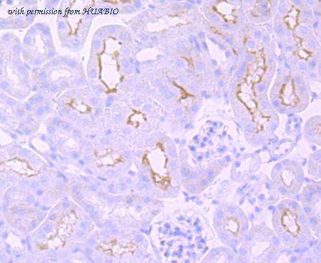 HUABIO ET1703-84 image 3