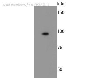 HUABIO ET1703-94 image 1