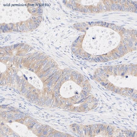 HUABIO ET1703-96 image 2