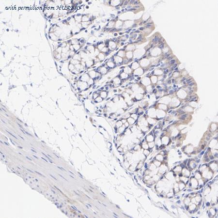 HUABIO ET1703-96 image 3