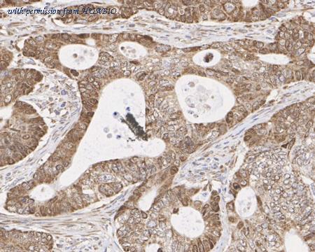 HUABIO ET1703-97-50UL image 3