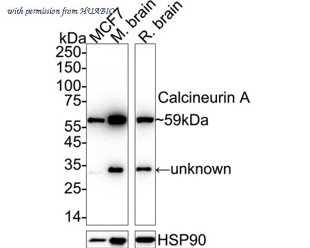 HUABIO ET1704-02 image 1