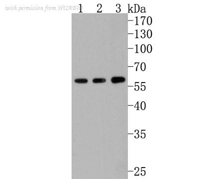 HUABIO ET1704-02 image 2