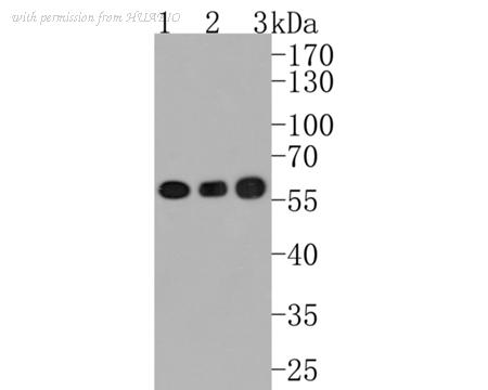 HUABIO ET1704-02 image 3